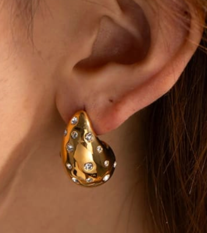 Arete Mirena