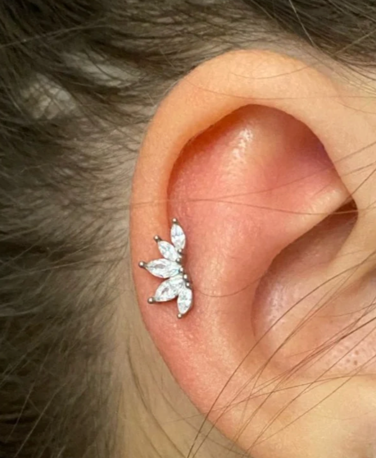 Arete Zorella